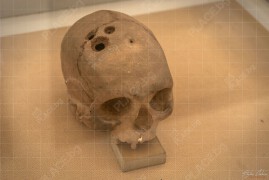 Археологически музей на Йордания – череп със следи от трепанация (BCH_6452)